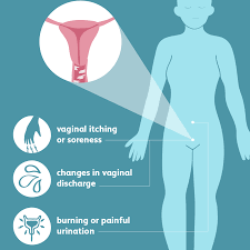 At some point in their lives, three out of every four women will experience vaginal. Yeast Infection Signs Symptoms And Complications