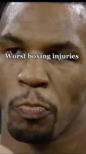 Mike Tyson Opponent with Brain Damage After Fight