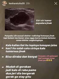 Meski begitu, tidak semua wanita hamil mengalami benjolan payudara atau tuberkel montgomery. Ada Benjolan Di Payudara Kesha Ratuliu Kenali Bedanya Kista Dan Tumor