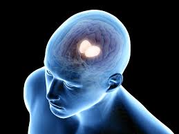 Image result for Thalamic Stimulation