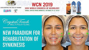 "Rehabilitation of Synkinesis"