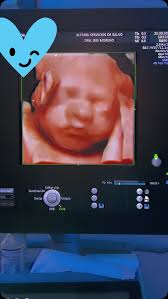 Sesión de fotos fetal
