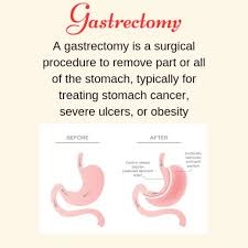 Image result for Succussion Splash