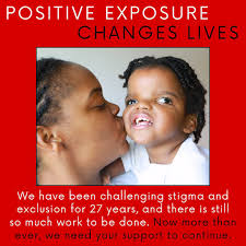 Positive Exposure (@positiveexposure) • Instagram photos and videos