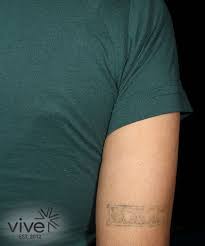 Avc is a division of oregon surgical specialists. Picosure Laser Tattoo Removal Vive Center Marlton Nj