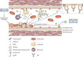 Pin On Deep Vein Thrombosis Dvt Pulmonary Embolism Pe Venous Thromboembolism Vte