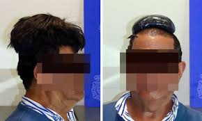 Out of the blue — tell me what you see 04:02. Man Held In Spain Over Attempt To Smuggle Cocaine Under His Wig Spain The Guardian