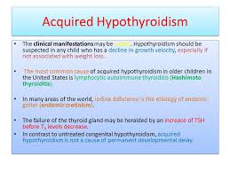 Symptoms commonly associated with hypothyroidism are often nonspecific (table 1). Thyroid Physiology And Development Dr M Ghasemi Ped Endocrinologist Kermanshah University Of Medical Science Dr M Ghasemi Ped Endocrinologist Kermanshah Ppt Download