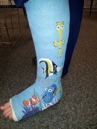 Hopefully I Won T Be Needed Another Cast Soon But This Is Seriously A Great Idea Cast Decoration Leg Cast Arm Cast