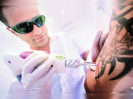 Sleeves, half sleeves, and full body. All You Need To Know About Laser Tattoo Removal Times Of India