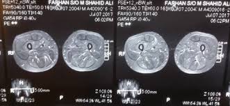 A ct scan (computerized axial tomography) produces highly detailed images of the anatomy and has become a valuable tool in the diagnosis and monitoring of many disease processes. Poster Abstracts 2019 International Journal Of Rheumatic Diseases Wiley Online Library
