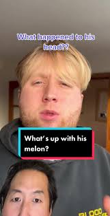 Understanding Mumps: Symptoms and Treatment Explained