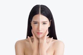 Warna kulit terdiri atas hitam (malanoderma) dan putih (leucoderma), serta variasi hitam dan putih, misalnya kuning (xanthoderma). Pewaris Sifat Dan Kelainan Sifat Pada Manusia Halaman All Kompas Com