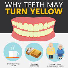 Why Do Teeth Turn Yellow Gorbatov Dentistry Your Dentist In Hollywood Sunny Isles Hallandale Miami Fort Lauderdale