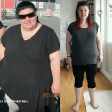Losing 140 Pounds With Fat Diet Doctor We suggest reading on about our 140 lbs to kg converter and chart. losing 140 pounds with fat diet doctor