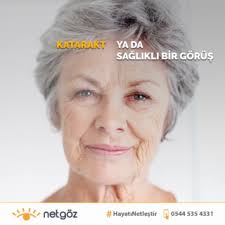 Katarakt Yada Halk Arasindaki Bilinen Adi Ile Goze Perde Inmesi Genellikle Ileri Yaslarda Ortaya Cikan Bir Goz Hastalig In 2020 Laser Eye Surgery Eye Surgery Laser Eye