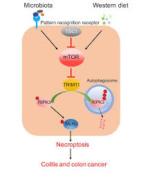 Compared to cancers of the distal colon, proximal colon cancers are more common in women, are associated with microsatellite instability and the this novel approach furnishes animals that closely mimic the progression of metastatic colon cancer in humans. Jci Gut Epithelial Tsc1 Mtor Controls Ripk3 Dependent Necroptosis In Intestinal Inflammation And Cancer