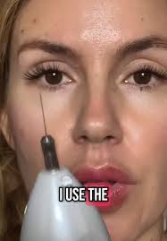 Plasma Pen Mole Removal at Home