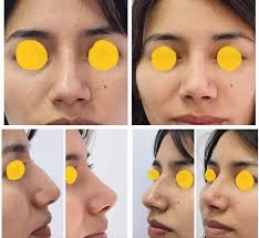 Victor Raul Valdivia Calderon (@victorvaldiviacalderon) • Instagram photos  and videos