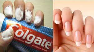 Conoce 5 Increibles Trucos De Belleza Con Pasta De Dientes Para Lucir Cada Dia Mas Bella Eliminar Hongos De Las Unas Trucos De Belleza Crecimiento De Unas