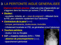 La péritonite aiguë est une affection grave que l'infirmier doit savoir diagnostiquer. Ppt Appendicites Powerpoint Presentation Free Download Id 489938