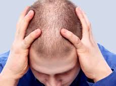 Fungal infections, allergic reactions to hair products, and inflamed hair follicles can. Does Burning Scalp Syndrome Cause Hair Loss