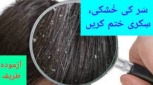 See more ideas about india travel, mughal architecture, travel dreams. Sar Ki Khushki Or Sikri Ka Ilaj In Urdu By Hakeem Barkat Ali Youtube