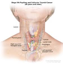 Neck Diagram Accomplice Music