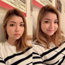 Dear crazygirl202, yes, removing buccal fat will make the cheeks thinner you have to be a good candidate for this procedure in order to get a good result best regards, nima shemirani. Getting Rid Of Chubby Cheeks 22f Plasticsurgery