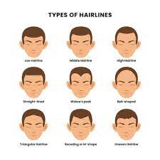 Widows Peak" Images – Browse 56 Stock Photos, Vectors, and Video | Adobe  Stock