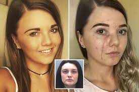 Woman glassed in the face by mum-of-two beautician in pub row removes ALL  mirrors from her home to avoid seeing her scars