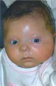 Ava Elderkin Obituary (2007)