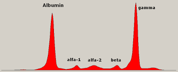 The amount of m protein in the blood or urine is measured by serum protein electrophoresis (spe or spep) or urine protein. Myeloma Protein Wikipedia