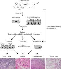 We did not find results for: Asbestos Induced Oxidative Stress In Lung Pathogenesis Springerlink