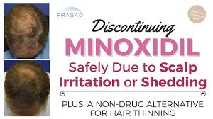 In women, genetic hair loss usually manifests as a gradual thinning along the part in the hair. Minoxidil Rogaine Proper Use Limitations Side Effects Ny Hair Loss
