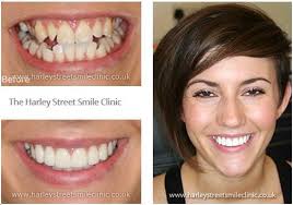 Our Smiles Harley Street Smile Clinic