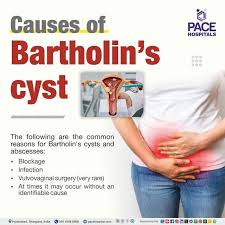 Image result for Bartholin's gland abscess