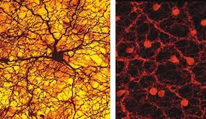 Which Cell Types In The Retina Produce Action Potentials? Choose All That  Are Correct: Photoreceptors Horizontal Cells Bipolar Cells Amacrine Cells  Retinal Ganglion Cells