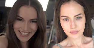 Fahriye evcen estetik doktoru kim? Fahriye Evcen Den Estetik Iddialarina Yanit Magazinn Com