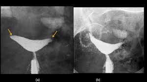 A vast treasure of urdu words offering a blissful explorative experience through a gallery of meanings, sounds, idioms and proverbs with poetic demonstrations. Epos Trade