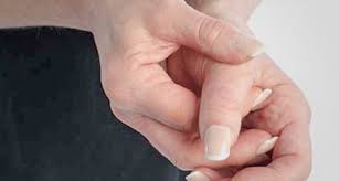 Ahhh….ahhh… dan tanpa aku sadari aku mengerang cukup keras dan kedengaran oleh mama. Radial Tenosynovitis Bengkak Di Pangkal Ibu Jari Bahayakah