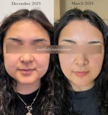 Hi! I'm Annie, an Aesthetic Registered Nurse who turned my lifelong passion  for beauty, skincare, and aesthetics into a career. I am a huge self-care  advocate, always urging my clients to invest