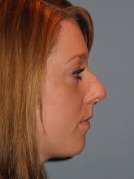 Dr Timothy M. Greco (@Drgrecoface)