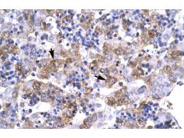 ↓ check how below ↓ step 1: Rabbit Anti Human Pou1f1 Antibody Abin2777285