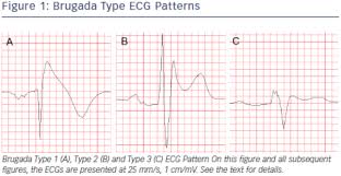 Did you take a good photo of this peak? Simple Education