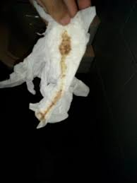 Manchado Marron 14 Dias De Retraso Apoyo Ayuda Y Consejos Durante El Embarazo Babycenter