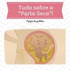 Pin On Parto