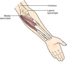It can affect people who do repeated wrist actions, such as weight lifters, downhill skiers, and canoeists. Forearm Tendinitis Musculoskeletal Key