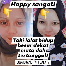 Meski demikian, tahi lalat memiliki karakteristik yang khas, yakni dari. Hukum Buang Tahi Lalat Hukum Gugurkan Kandungan Adakah Ia Dibenarkan Aku Muslim Meski Demikian Tahi Lalat Memiliki Karakteristik Yang Khas Yakni Dari Klak