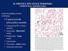 Frotiu De Sange Pentru Paraziți Frotiu Hemoparaziti Synevovet